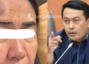 Dugaan KDRT Anggota DPR RI Rudi Hartono Bangun Memanas: Eks Istri Mengaku Diancam Dihabisi hingga Dimiskinkan