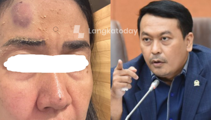 Dugaan KDRT Anggota DPR RI Rudi Hartono Bangun Memanas: Eks Istri Mengaku Diancam Dihabisi hingga Dimiskinkan