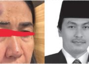 Partai Nasdem Diduga Lindungi RHB dari Kasus Penganiayaan Mantan Istri