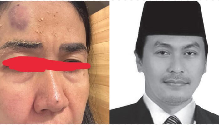 Partai Nasdem Diduga Lindungi RHB dari Kasus Penganiayaan Mantan Istri